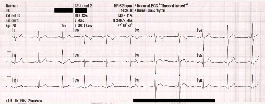 ECG & Cardiac Monitoring
