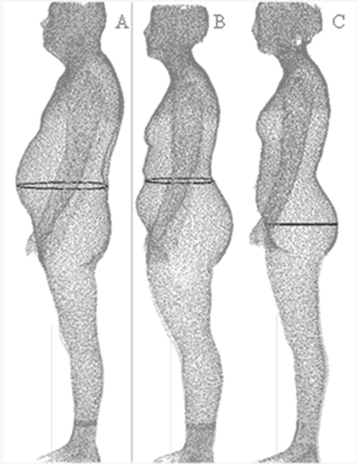 Obesity & Weight Management Programs