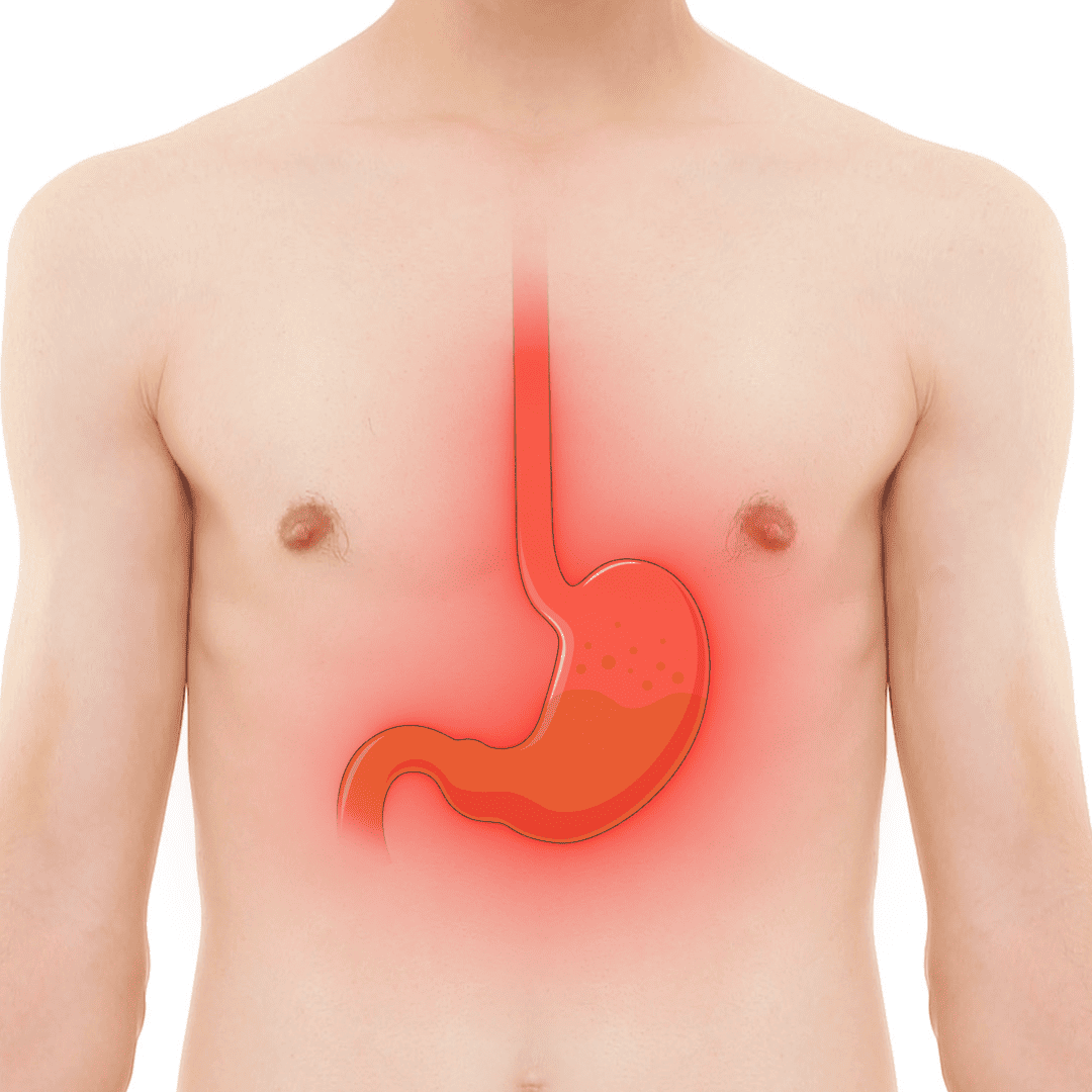 Acidity, Gas & Indigestion