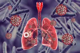 Tuberculosis (TB) Management